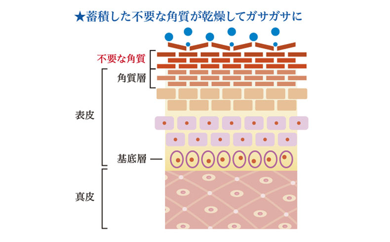 蓄積した不要な角質が乾燥してガサガサに